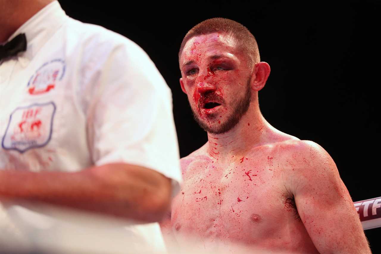 After the gruesome destruction in Eddie Hearn’s garden of Jazza Dickens, Kid Galahad wins the world title