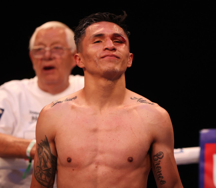 Josh Warrington and Mauricio Lara fight ends in DRAW, after headbutt causes severe cut to Mexican's left eye