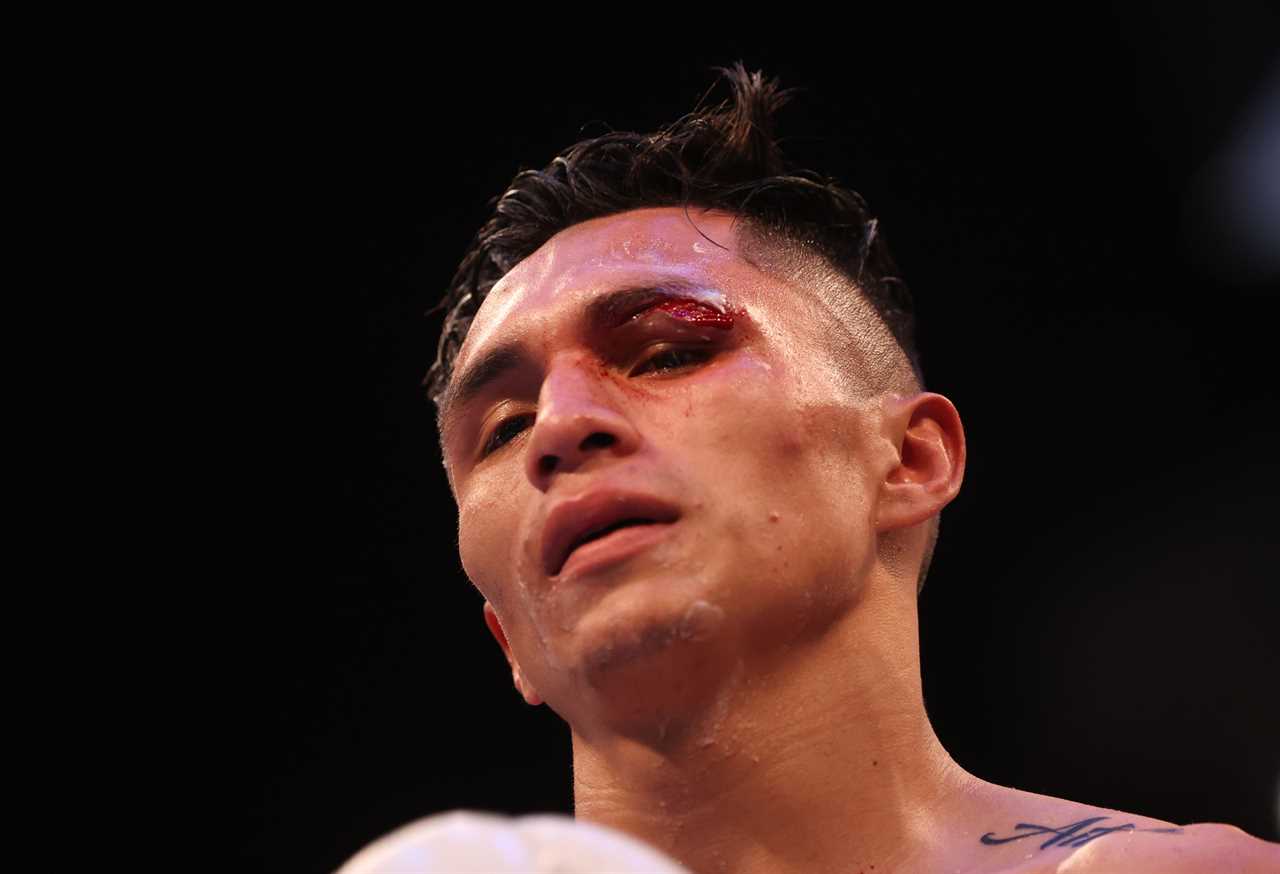 Josh Warrington could abandon a rematch against Mauricio Lara to land American dream bout against Mexican facing year after gash