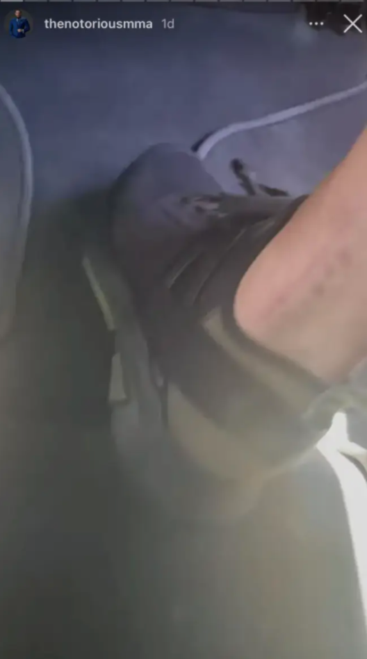 After UFC star Conor McGregor says he feels like he can kick right now, Conor McGregor shows off his huge scars from a broken leg.