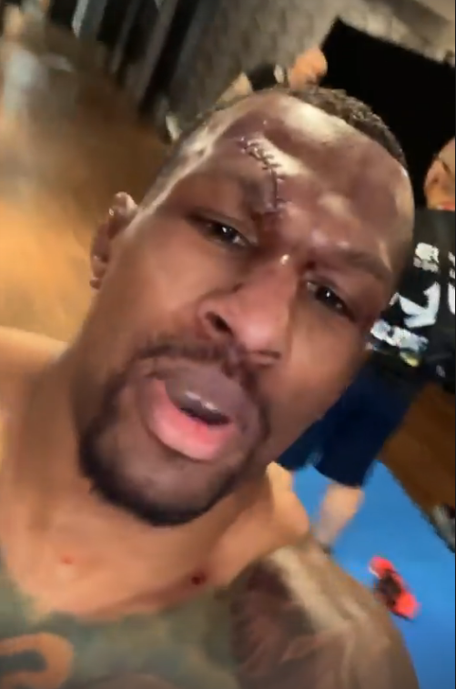MMA star Kane Mousah was left with a terrible gash above the eye. Fans hail 'warriors' despite Bellator 267 loss