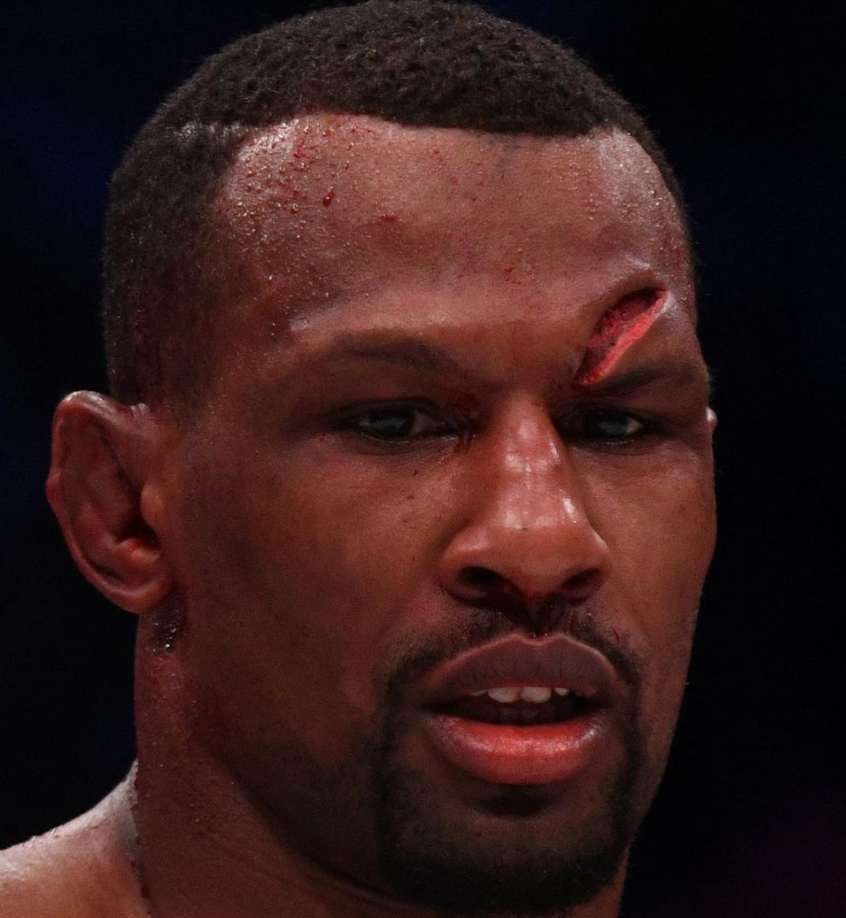 MMA star Kane Mousah was left with a terrible gash above the eye. Fans hail 'warriors' despite Bellator 267 loss