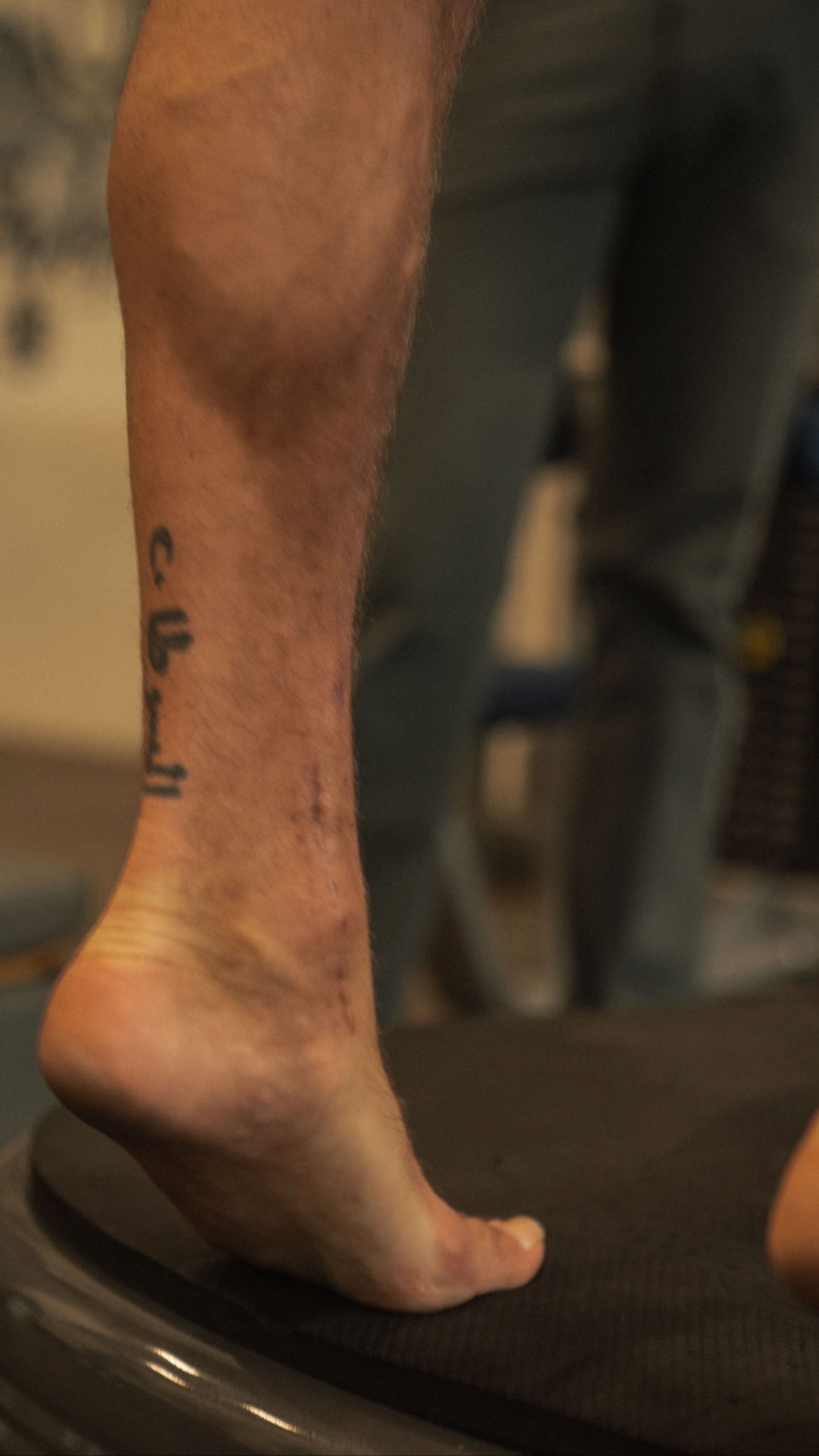 Conor McGregor's bulky calf muscles are displayed as he continues to recover from a horror-related broken leg.