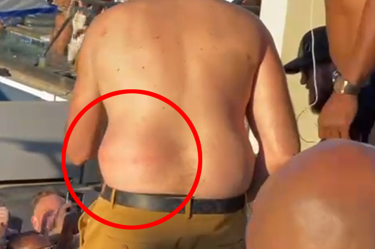 Tyson Fury enjoys a pool party with his wife Paris, brother Tommy, and friends while he displays the scars of war alongside Deontay Wilder