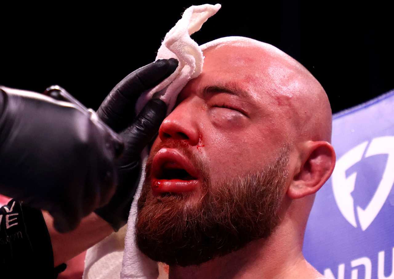 Adam Kownacki, Heavyweight Star, banned from blowing his nose after breaking skull during Fury vs Wilder Card