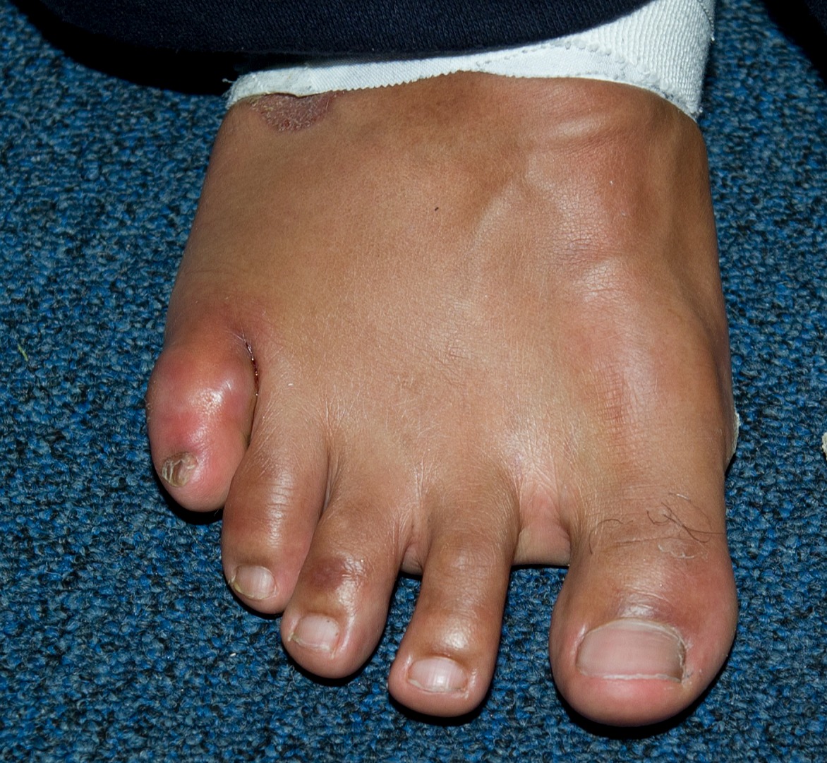 Anthony Joshua makes a veiled dig at David Haye, saying he will NEVER excuse an injured baby toe.