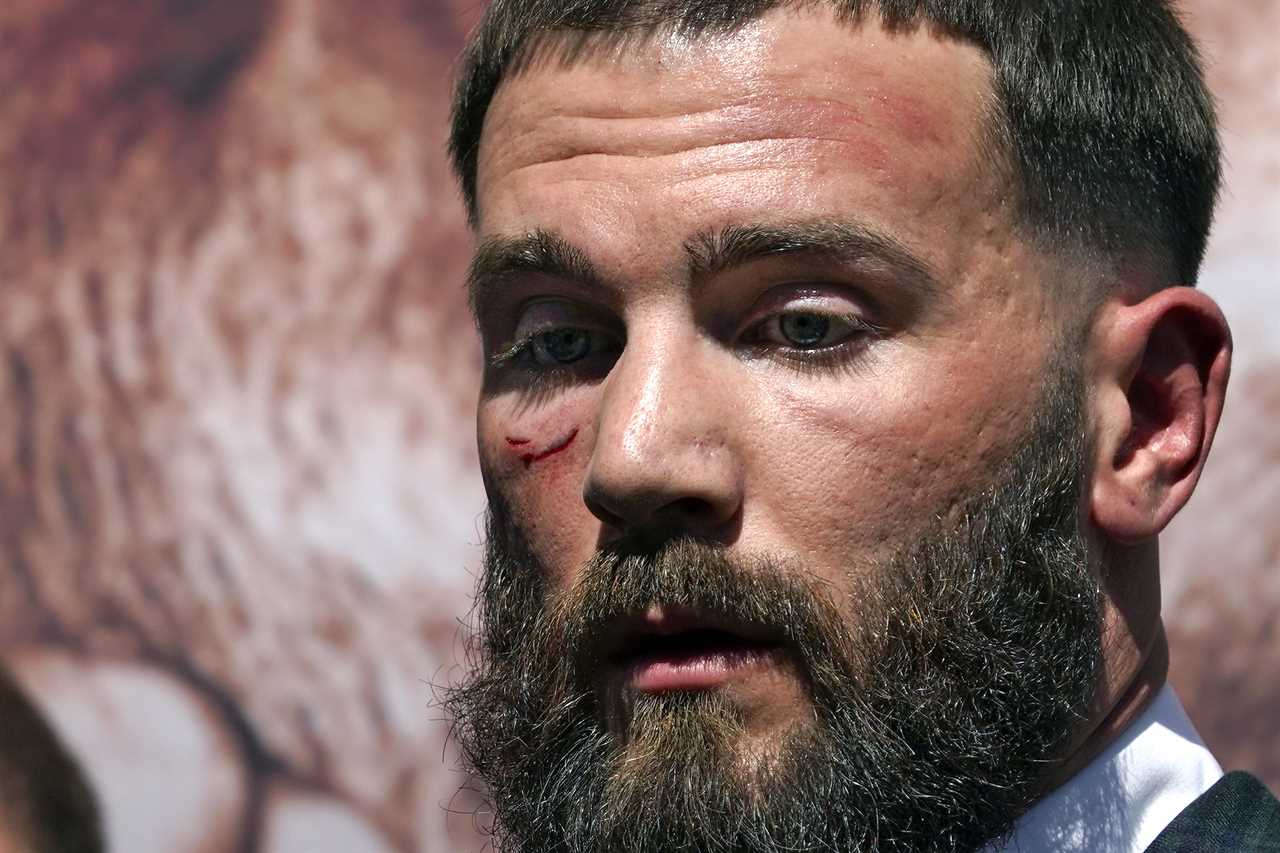 Caleb Plant may have suffered from eye injury in Canelo Alvarez brawl, which could have had an impact on sparring preparations. Carl Frampton fears