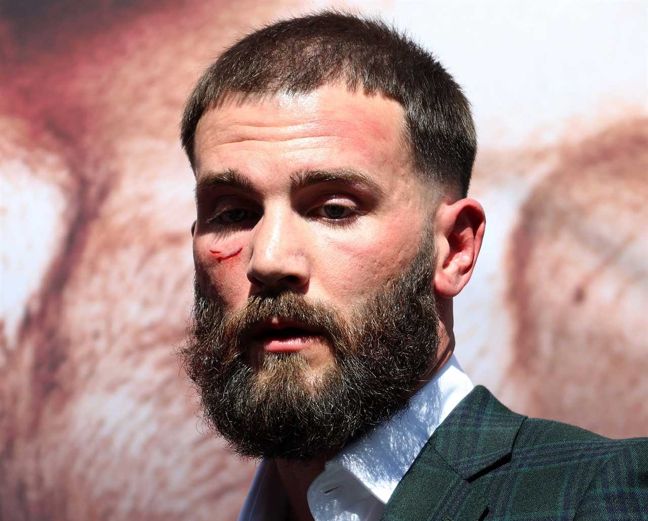 Canelo Alvarez and Caleb Plant could become a bloodbath... this IS NOT a fake grudge match