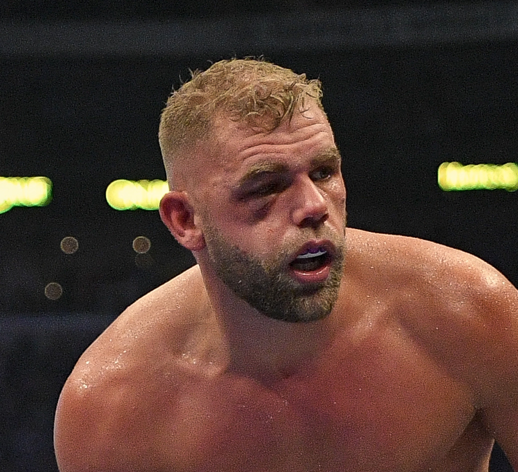 Canelo Alvarez ENJOYED breaking Billy Joe Saunders’ eye socket and is eager to inflict pain upon Caleb Plant