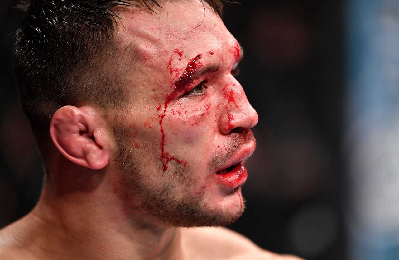 Justin Gaethje makes Michael Chandler look like a bloody mess after his brutal UFC 268 win. BOTH fighters were taken to the hospital.