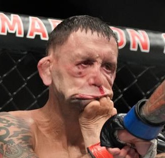 Frankie Edgar, UFC's ace, looks completely different after being kicked in the face by Marlon vera just before brutalKO