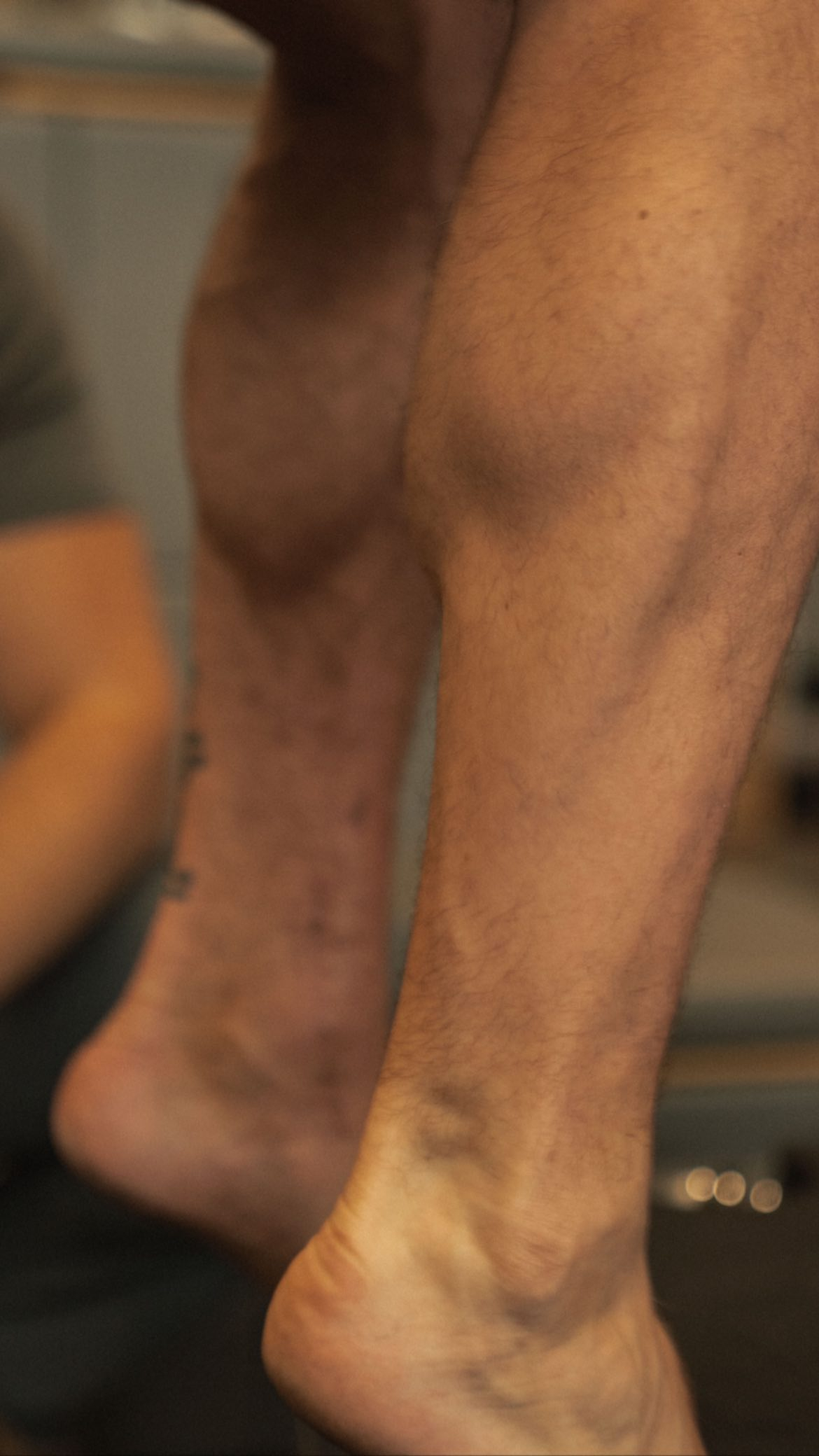 Conor McGregor would like to use steel bar in his leg as a 'WEAPON', and 'can’t wait to wrap that around the neck of UFC opponent's'