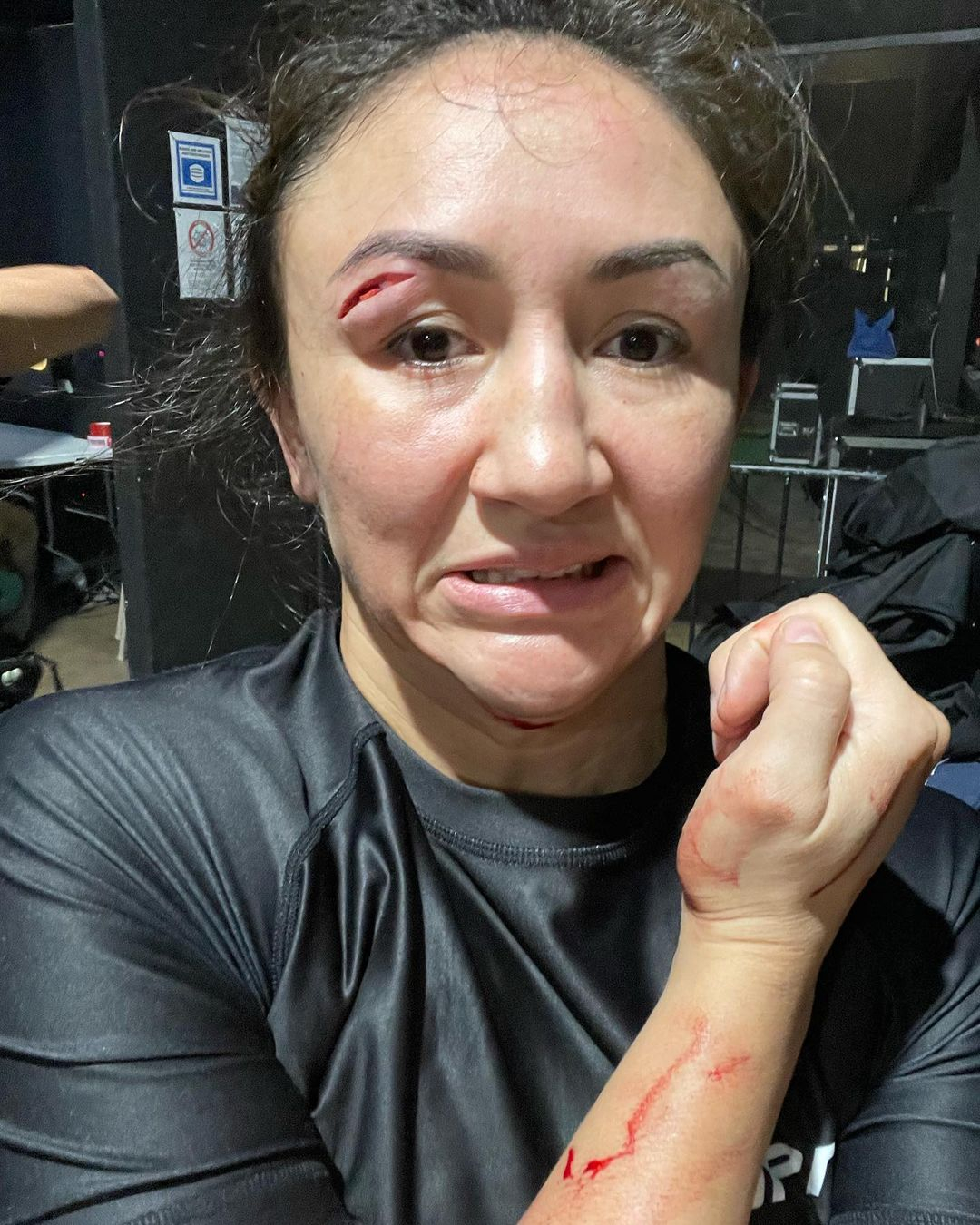 UFC star Carla Esparza is horrified by an eye injury that saw her Fury Pro Grappling submission stop early