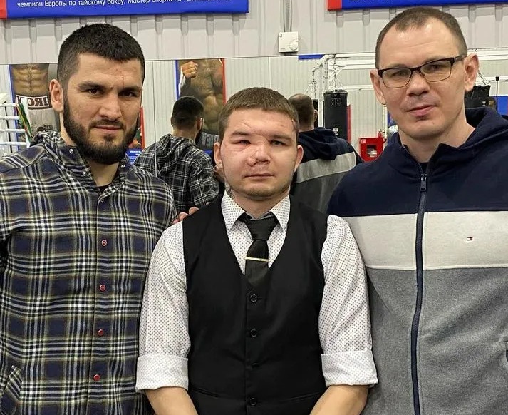 After suffering horror injuries in fighting off a bear that killed a friend on a fishing trip, the hero boxer was unable to be identified.