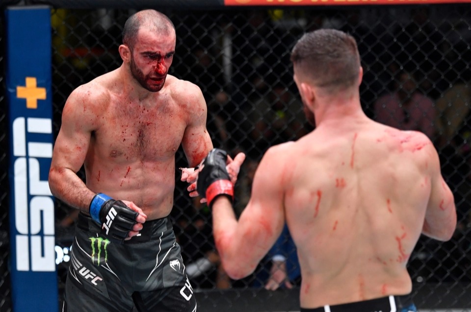 UFC star Giga Chkadze displays a bloody face and horrendous post-fight injuries following a brutal Calvin Kattar fight