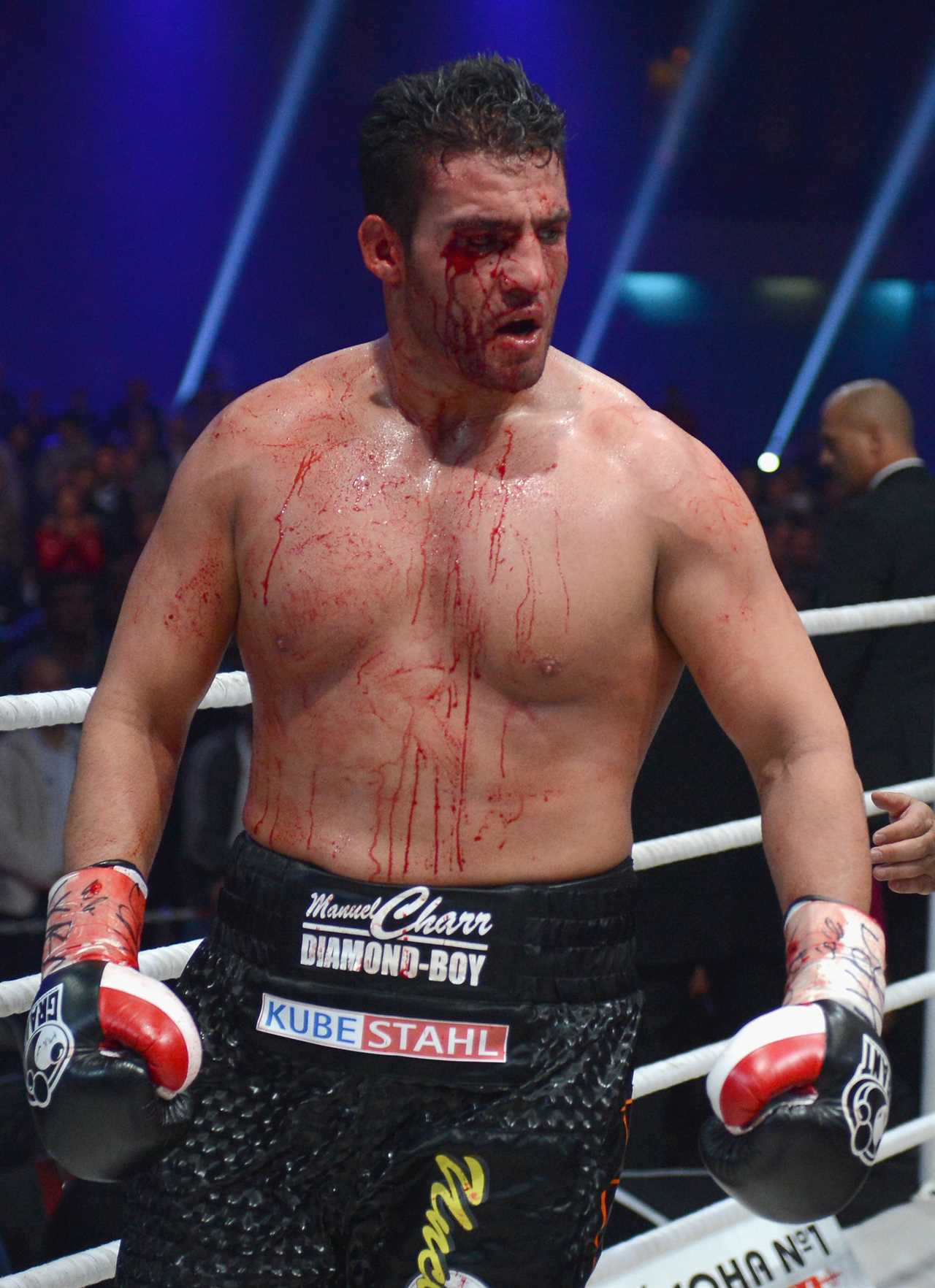 As talks continue over the 80/20 purse stall, Tyson Fury may fight Robert Helenius and Manuel Charr rather than Dillian Whyte.