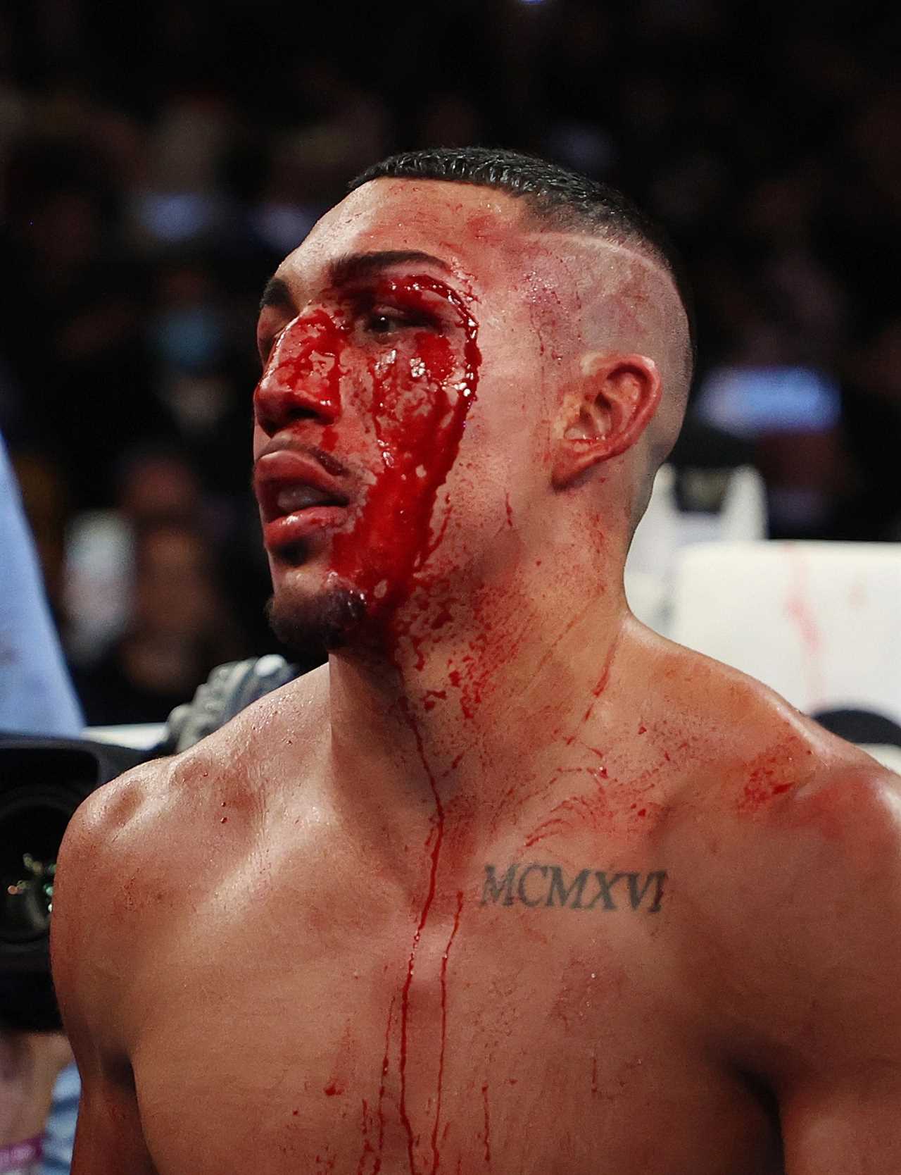 Teofimo Lopez ‘almost died’ making weight for George Kambosos defeat, claims promoter Bob Arum