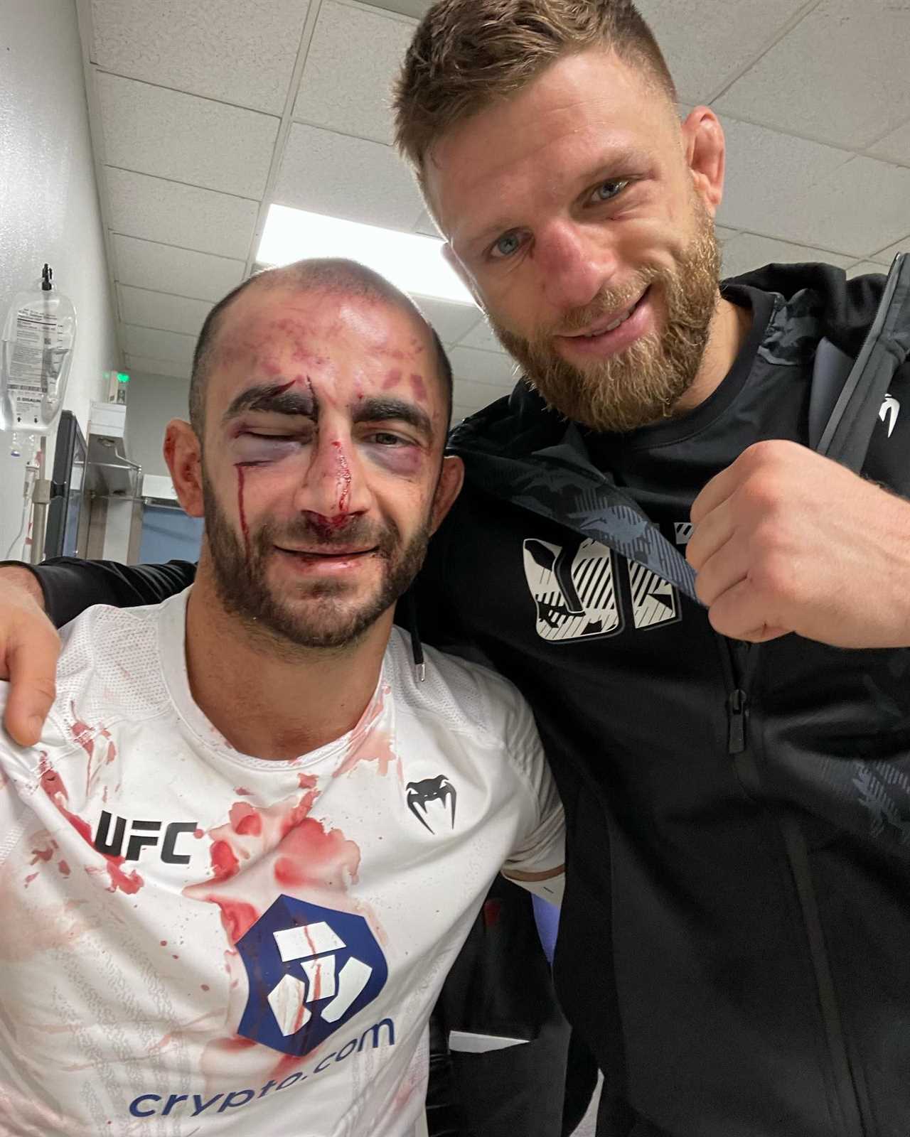 UFC star Giga Chikadze was suspended INDEFINITELY after a brutal beating. She can only fight again after an MRI scan.