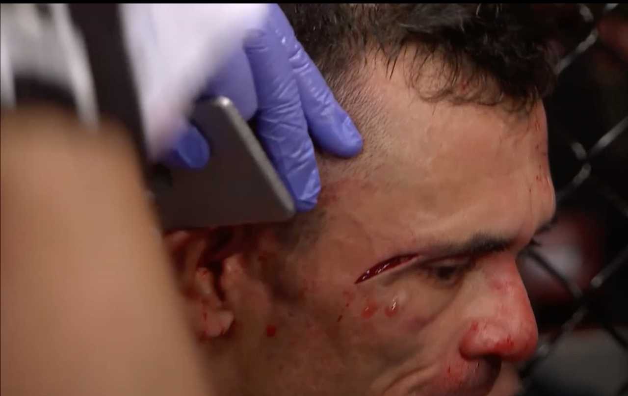 UFC 271: Watch Bloodied Douglas Silva de Andrade choke Sergey Morozov UNCONSCIOUS, after he suffered a HORRIFIC cut