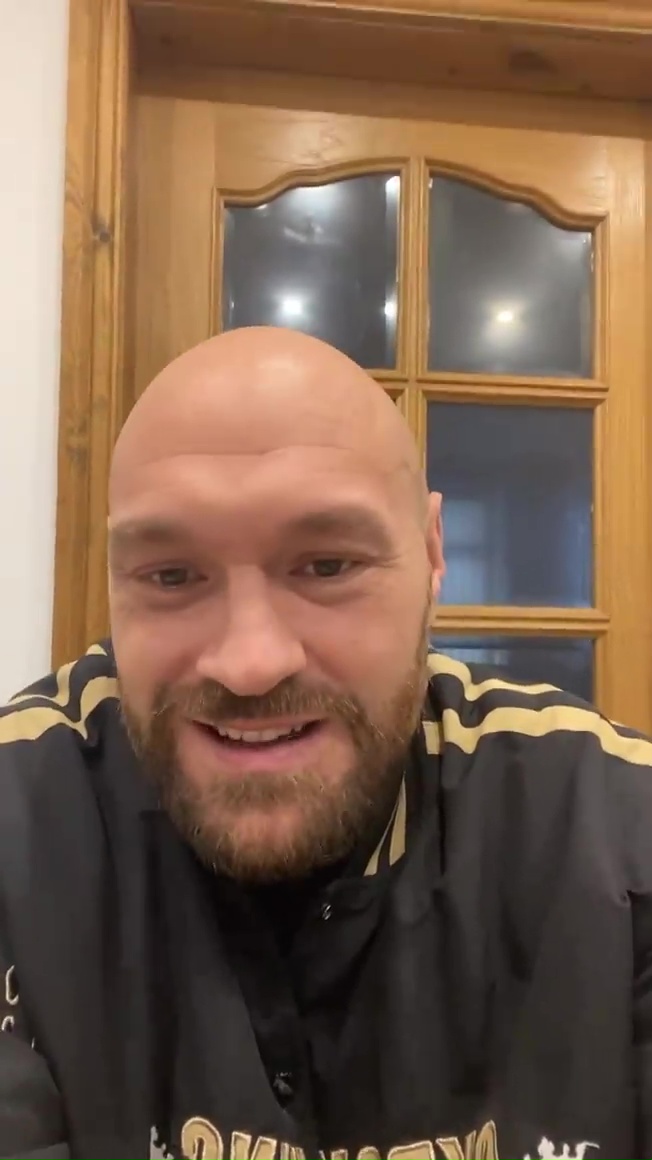 What a surprise - Tyson Fury mocks Dillian Whyte with an American accent after signing a PS30m fight contract.
