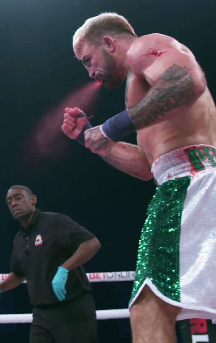 Mike Perry, ex-UFC star, spits blood during five-round brutal bare-knuckle boxing victory against Julian Lane