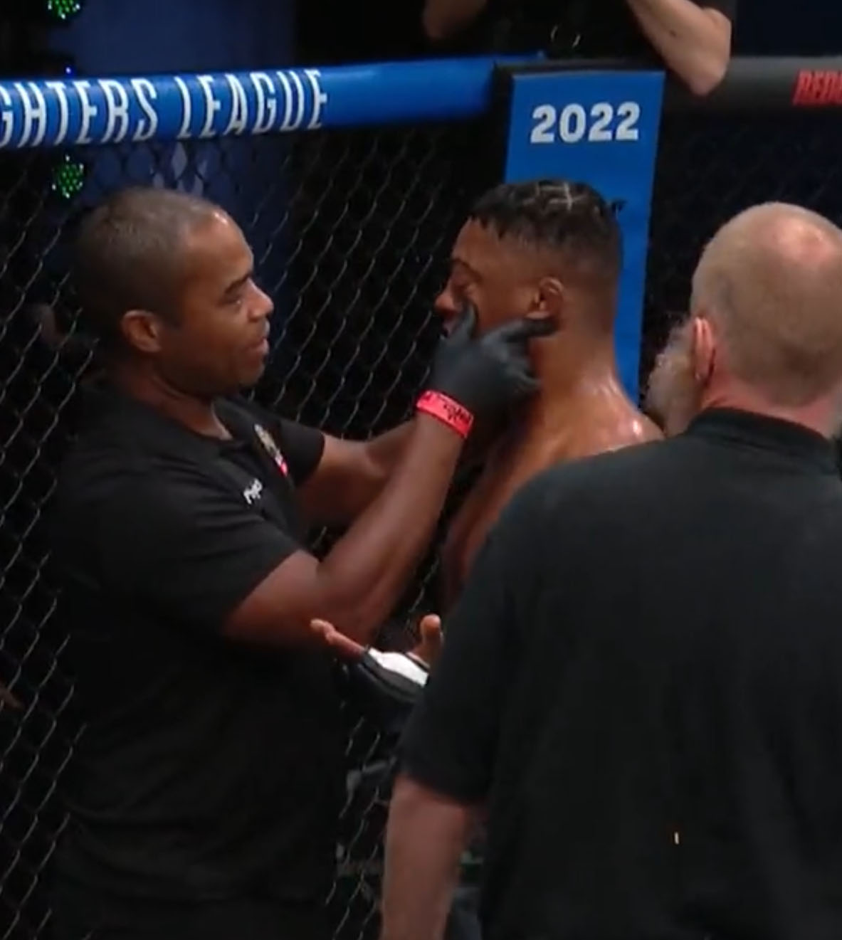 A shocking moment in which an MMA fighter had his eyeballs punched out of SOCKET, leaving viewers squirming until the doctor can get it fixed.