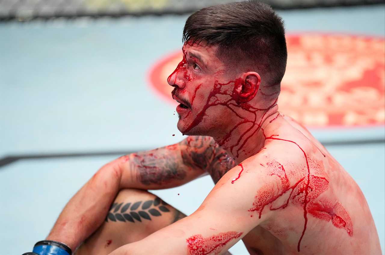 Joel Alvarez's nose is EXPLODES, and MMA fighter is covered in blood following a brutal beating in UFC Vegas 49 loss