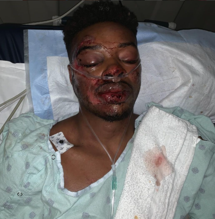 After a life-threatening car accident and horror eye injury, Errol Spence Jr. has 'a second chance at life' and a third chance in boxing