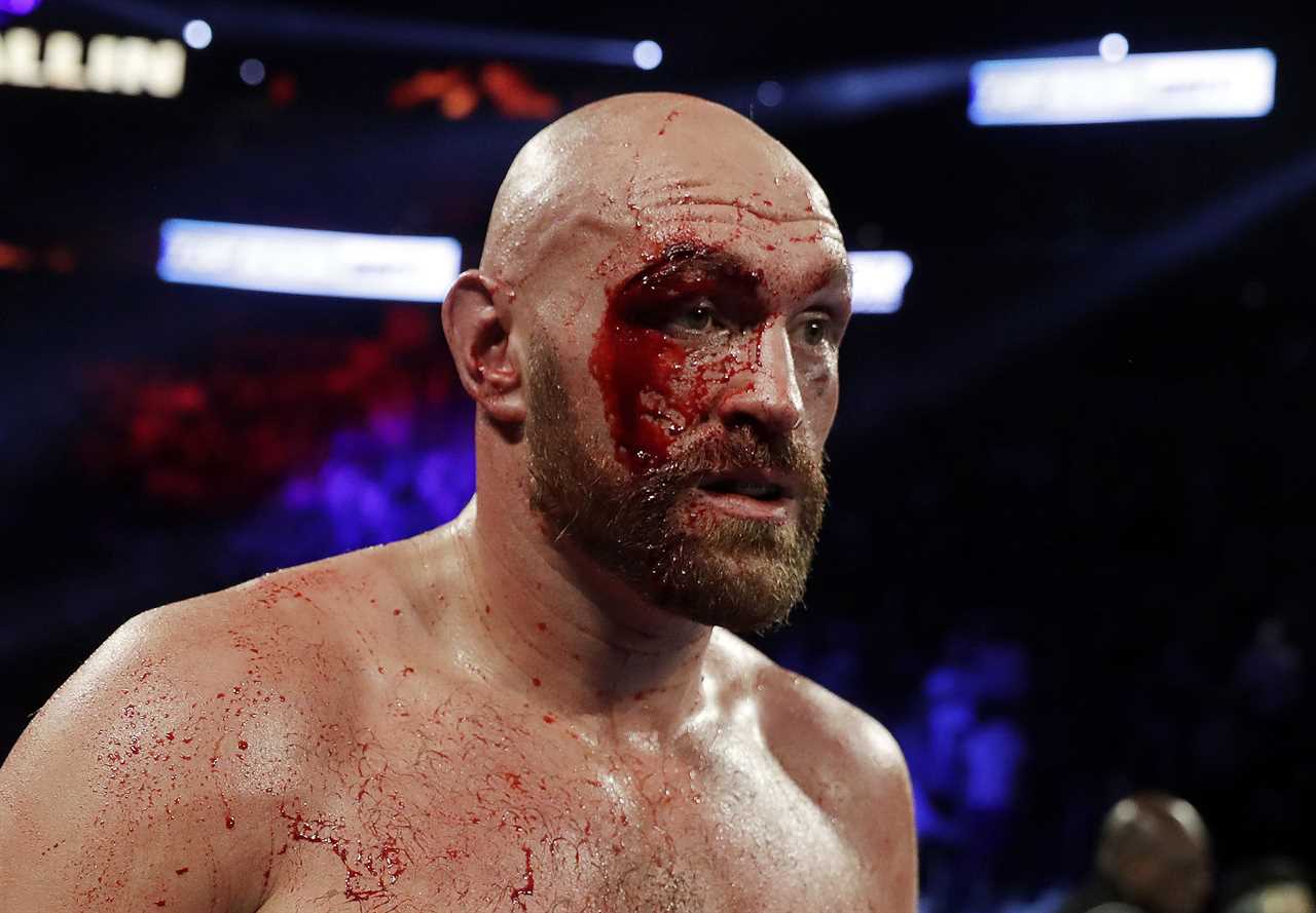 Otto Wallin calls Anthony Joshua out if Usyk defers a rematch... but fears Tyson Fury 47 stitches might scare him off