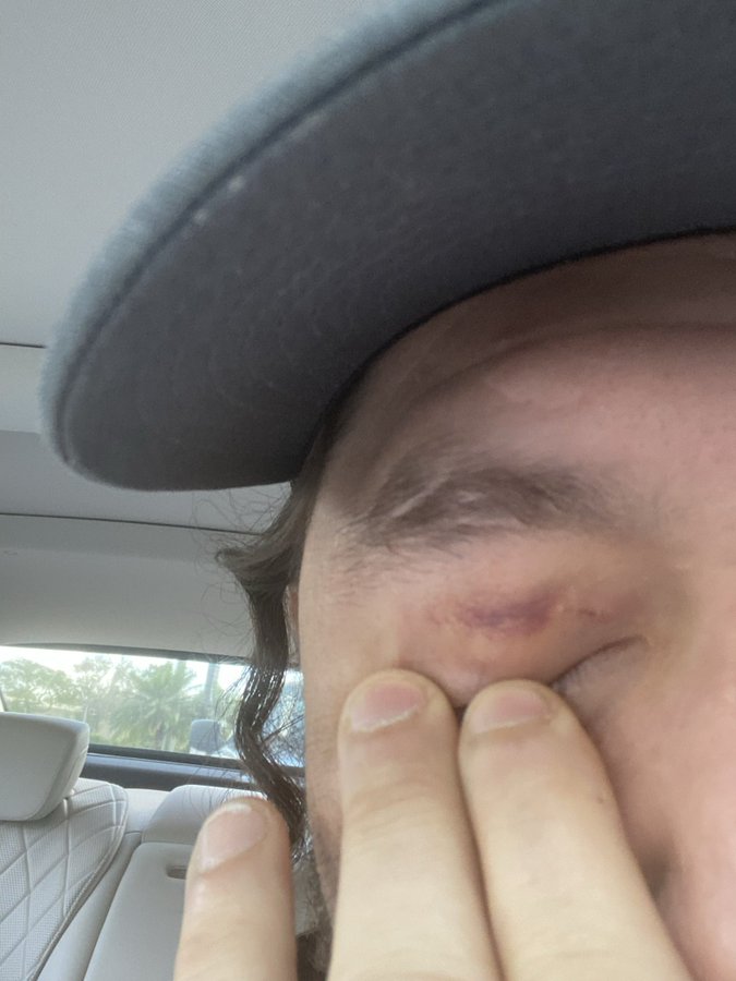 ‘You cheating f***’ – UFC star Jorge Masvidal accuses Colby Covington of nearly taking his EYE out during brutal fight
