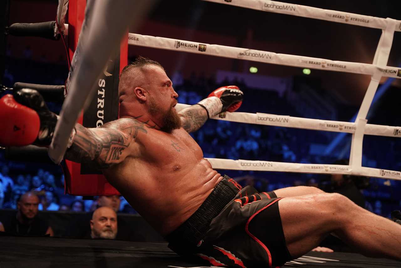 After Games of Thrones wins, Thor Bjornsson displays a brutal black eye.