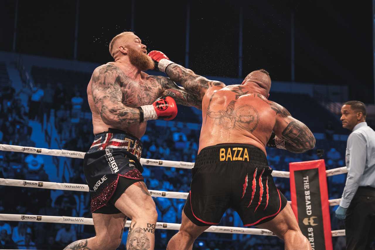 After Games of Thrones wins, Thor Bjornsson displays a brutal black eye.