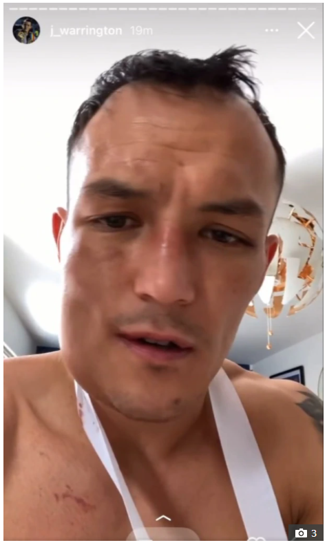 After suffering a broken jaw in the brutal Kiko Martinez fight, Josh Warrington is considering liquidating KEBAB