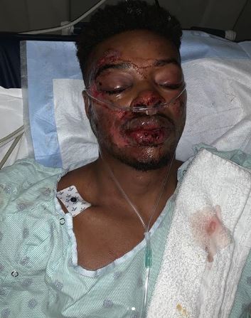 Errol Spence Jr. suffers from PTSD following horror car accident and reveals that he was involved in road collision just three months later