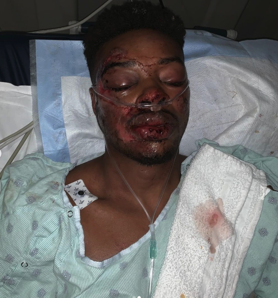 Errol Spence Jr. refuses to fight in tune-up bouts after a car accident and eye injury. He is now one win away from the Terence Crawford bout