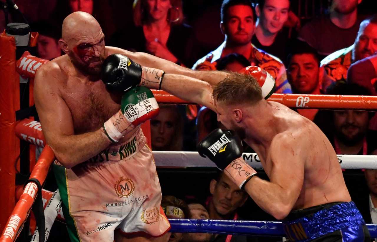 How Tyson Fury feels when he is in the ring with you and how Dillian Whyte has to fight for upset