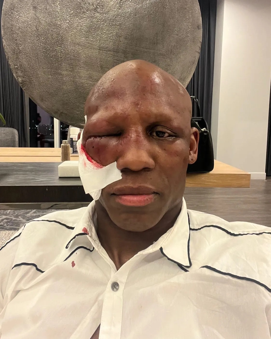 Yordenis Ugas has a disturbing update on horror injury. He reveals that he couldn't open his right eye for 40 hours.