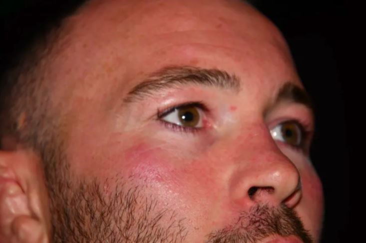UFC star Colby Covington displays a chipped tooth after being attacked in the street by Jorge Masvidal.
