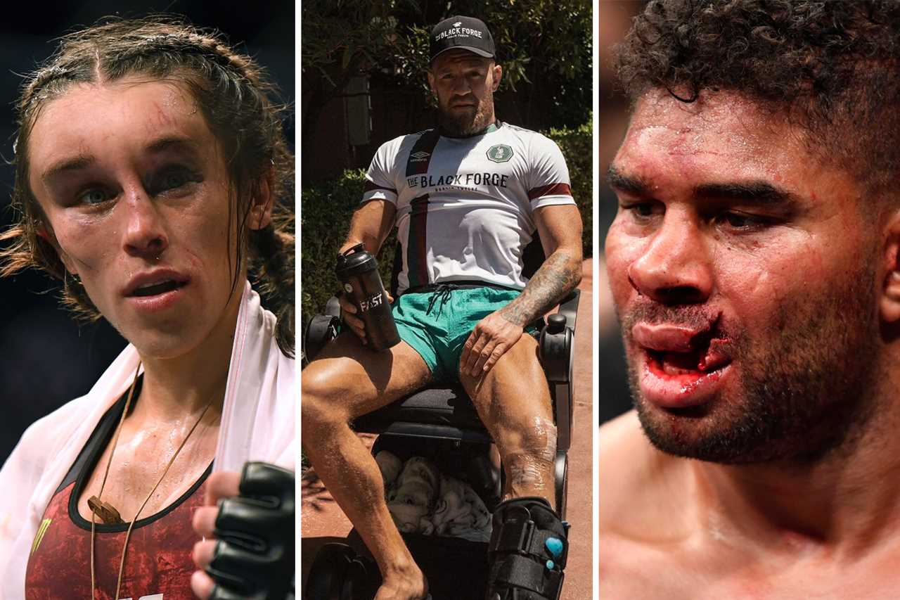 Tony Ferguson was almost unrecognizable after being disfigured by brutal front KO by UFC rival Michael Chandler.