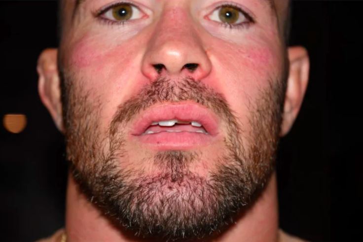 Masvidal will be allowed to inspect Covington’s Rolex Watch for $95k to verify its authenticity after it was damaged.