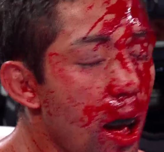 Bermudez was a mess after being battered at the Hearn event's eighth round KO to Japanese star Kyoguchi