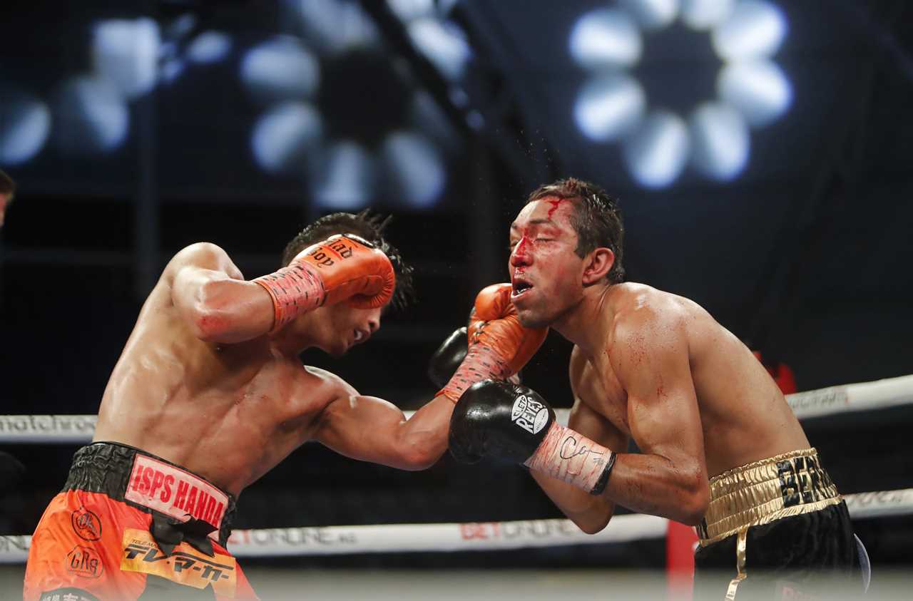 Bermudez was a mess after being battered at the Hearn event's eighth round KO to Japanese star Kyoguchi