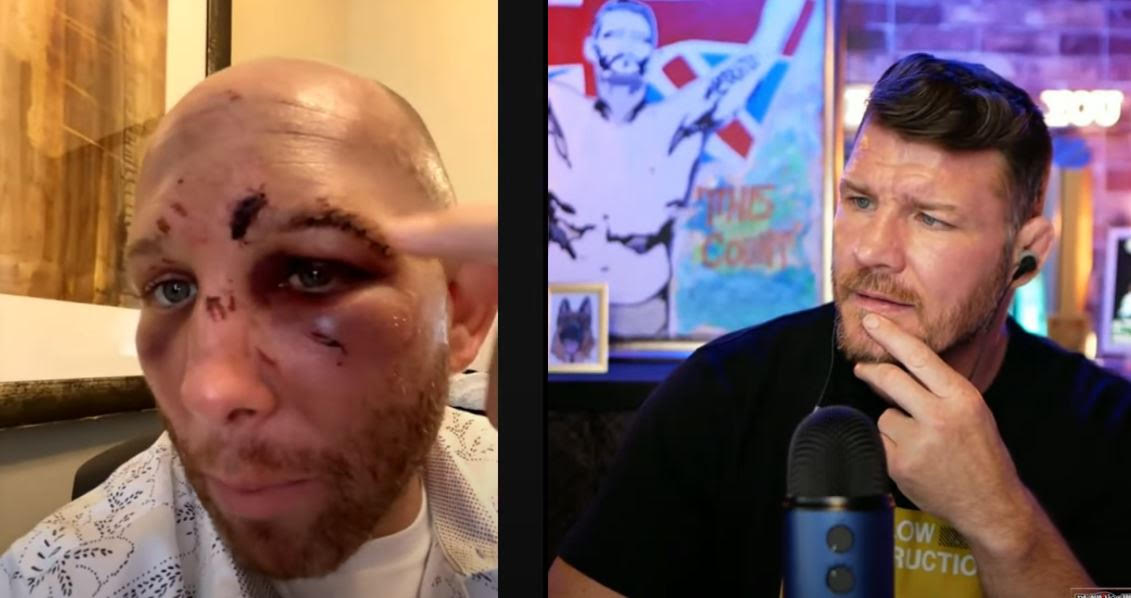 UFC star Josh Emmett is unrecognizable after a brutal fight. He shows his wounds on Michael Bisping’s podcast