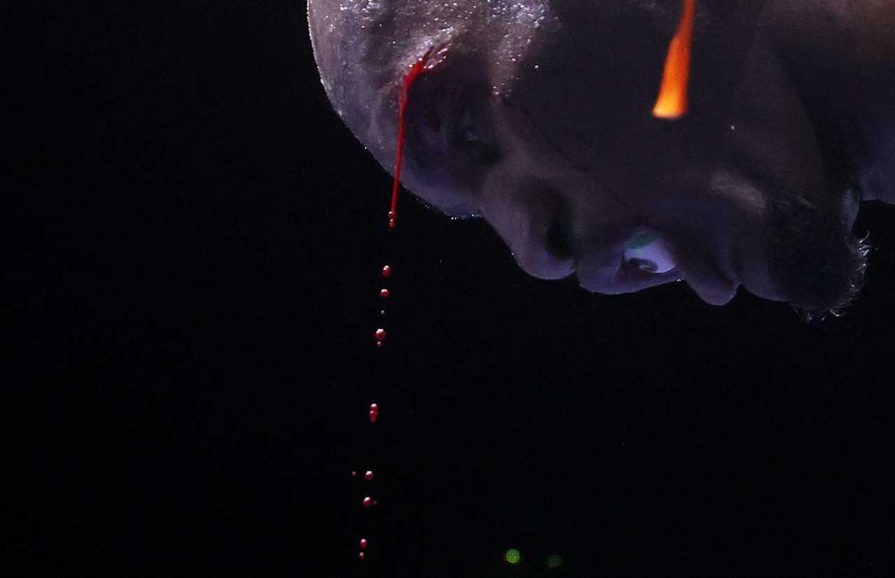 Michel Soro, boxer, suffers horror cut after a head clash with Israil madrimov causes their fight in controversy AGAIN