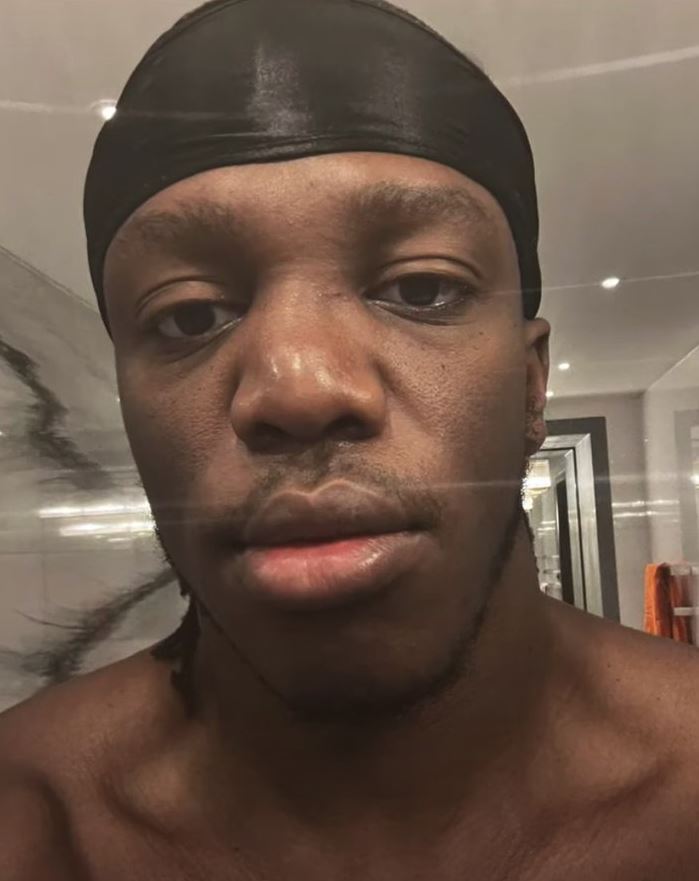 KSI's broken nose is visible, but British YouTube star Alex Wassabi is still in the fight for his boxing return.