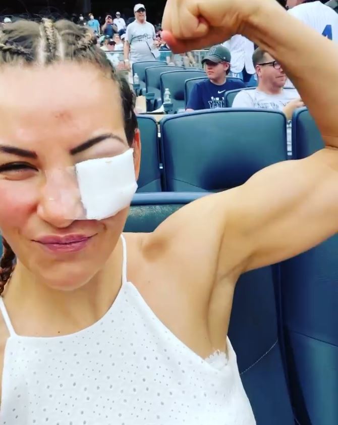 Miesha Tate, UFC legend, forced to wear an eye patch after suffering horrific injuries in Lauren Murphy's loss