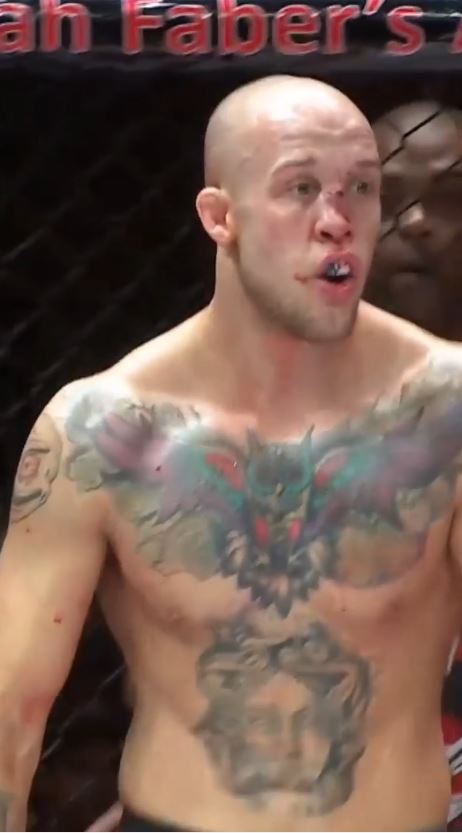 After taking a brutal knee at A1 Combat 4 in Atlanta, MMA star Blake Perry suffered a horrendous bent nose.