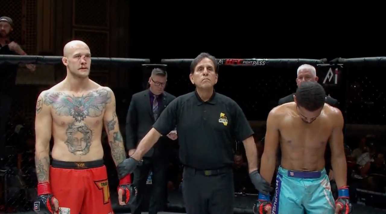 After taking a brutal knee at A1 Combat 4 in Atlanta, MMA star Blake Perry suffered a horrendous bent nose.