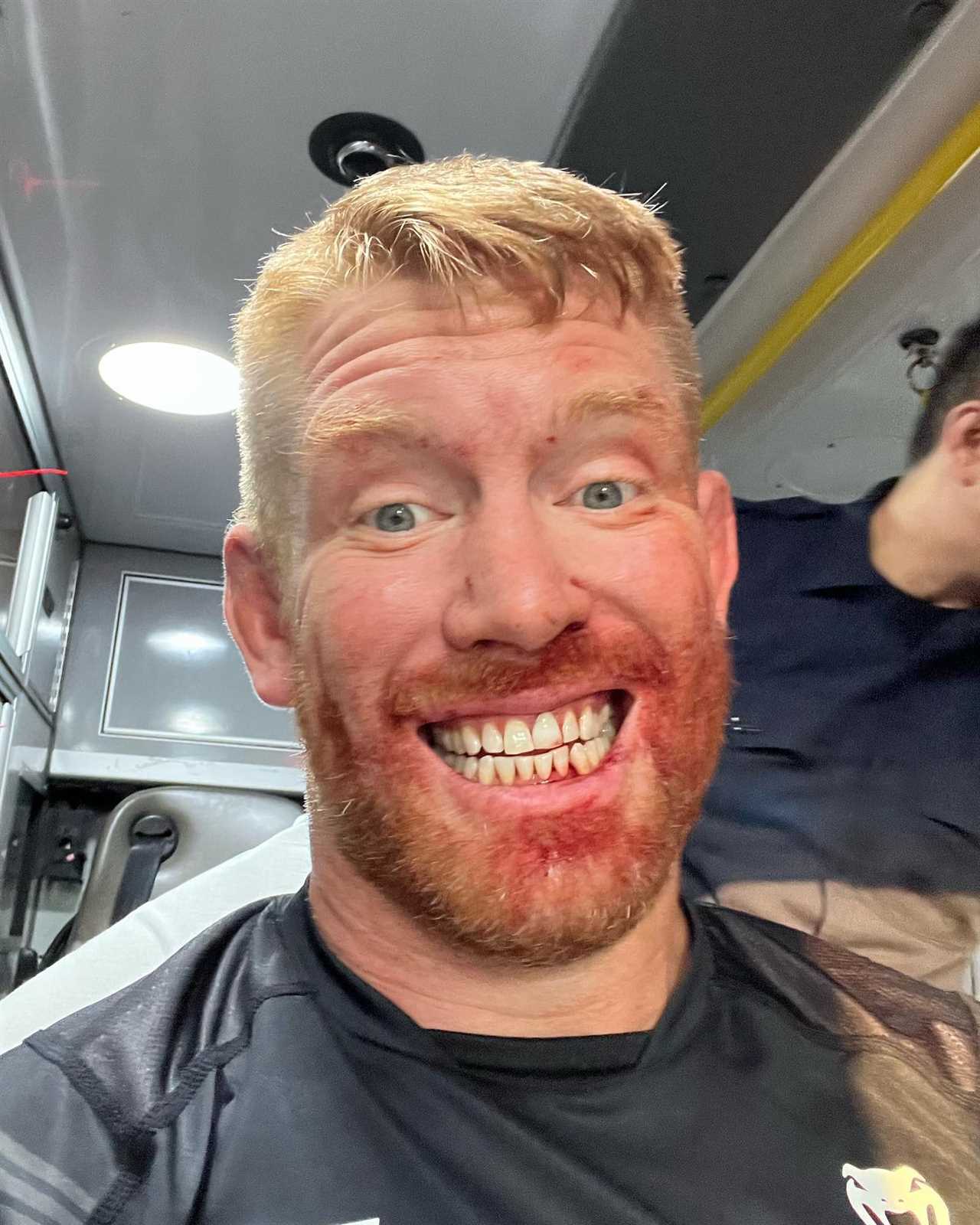 UFC star Sam Alvey has a horrific broken jaw after Michal Oleksiejczuk's KO loss. He needs surgery to keep his 'wire mouth closed'