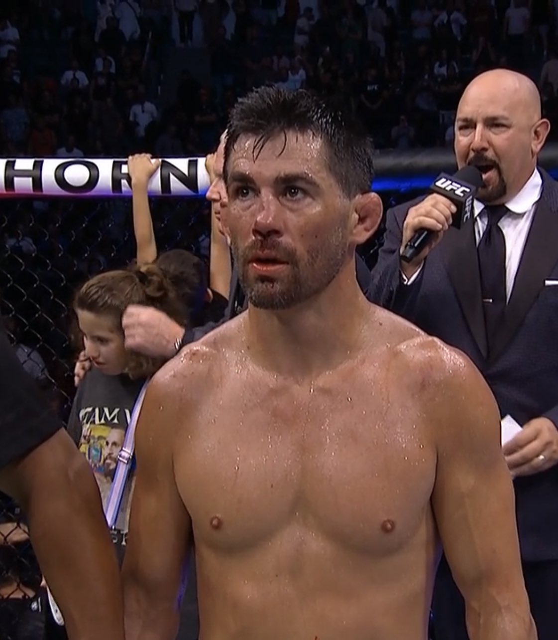 Ex-UFC champ Dominick Cruz is left with a broken nose after he was subject to a brutal Marlon Vera headkick at UFC San Diego.